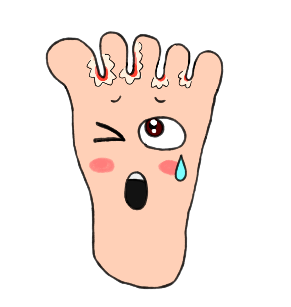 水虫痒すぎる
